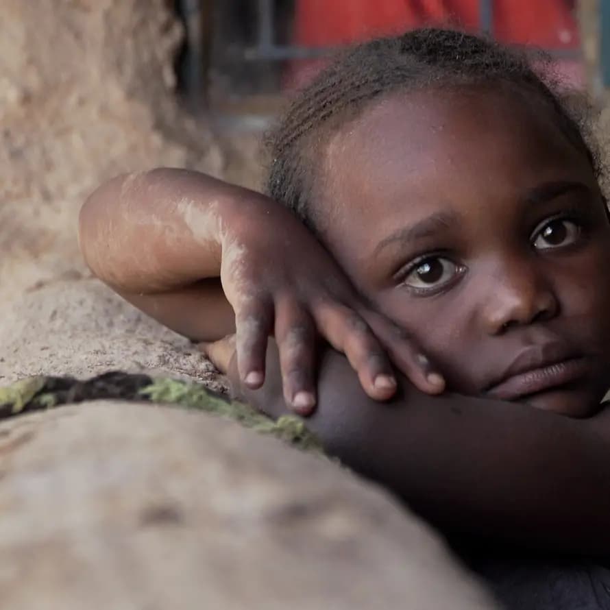 SOS-Kinderdorf hilft Kindern wie Grace in Afrika SOS-Kinderdorf hilft Kindern wie Grace in Afrika